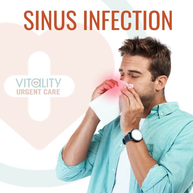 Sinus infection